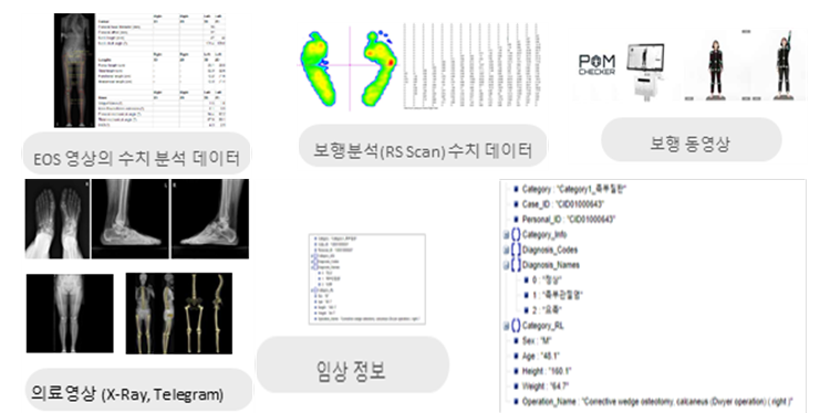 족부질환 및 재활경과 판단을 위한 보행 동영상-데이터 저장구조_1