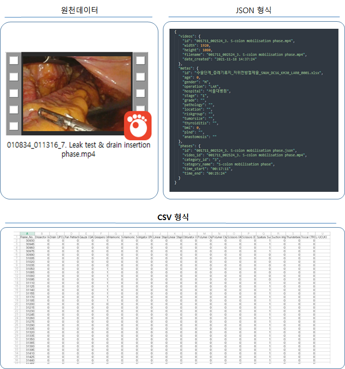 6개암 최소침습수술 AI학습데이터-데이터 포맷-수술단계 Cholec80 type