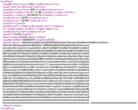 심장질환 진단을 위한 심전도 데이터-심전도 데이터_1_원천데이터(JSON)