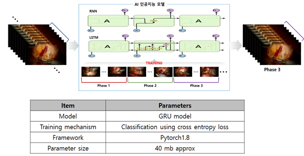 6개암 최소침습수술 AI학습데이터-모델 학습-GRU 기반의 수술단계 구분 모델
