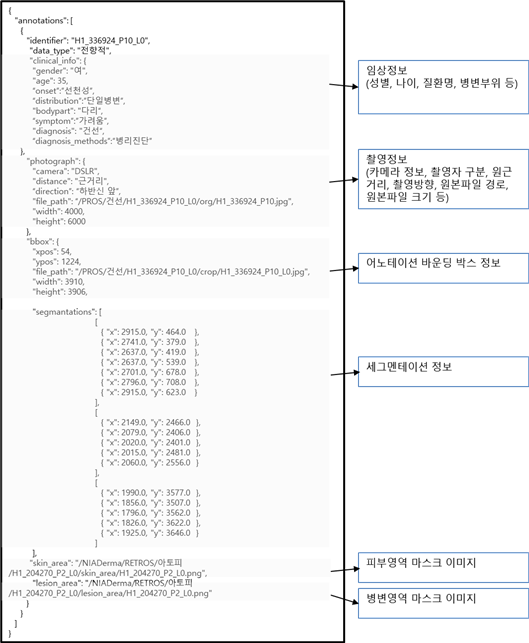 소아청소년 피부질환 이미지-메타데이터(JSON) 예시_1