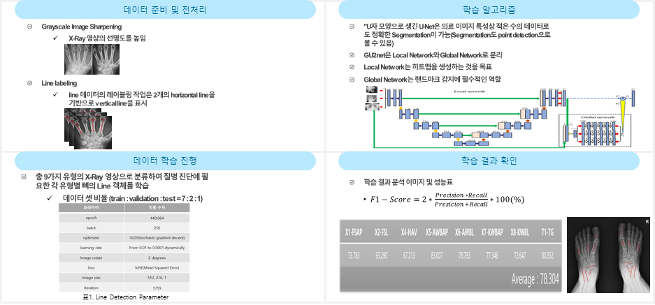 족부질환 및 재활경과 판단을 위한 보행 동영상-활용모델_2_Line Detection 모델