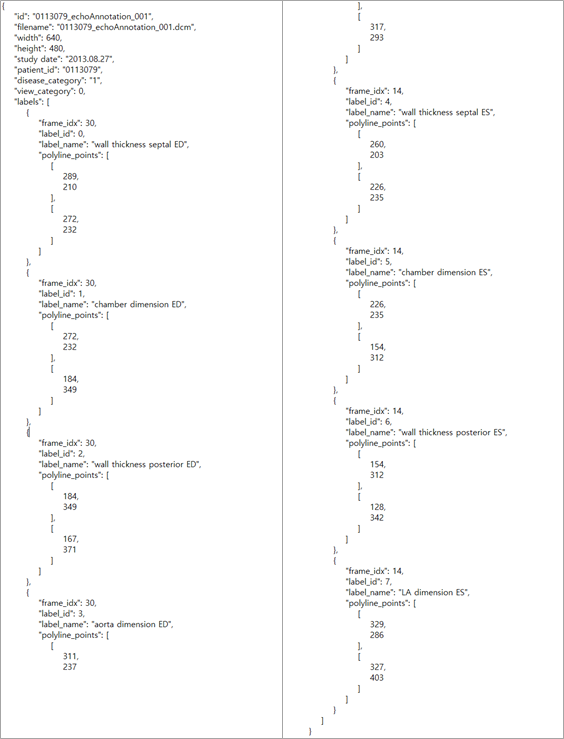 심장질환 진단을 위한 심초음파-라벨링데이터 실제예시_1_경흉부 심초음파 라벨링 데이터