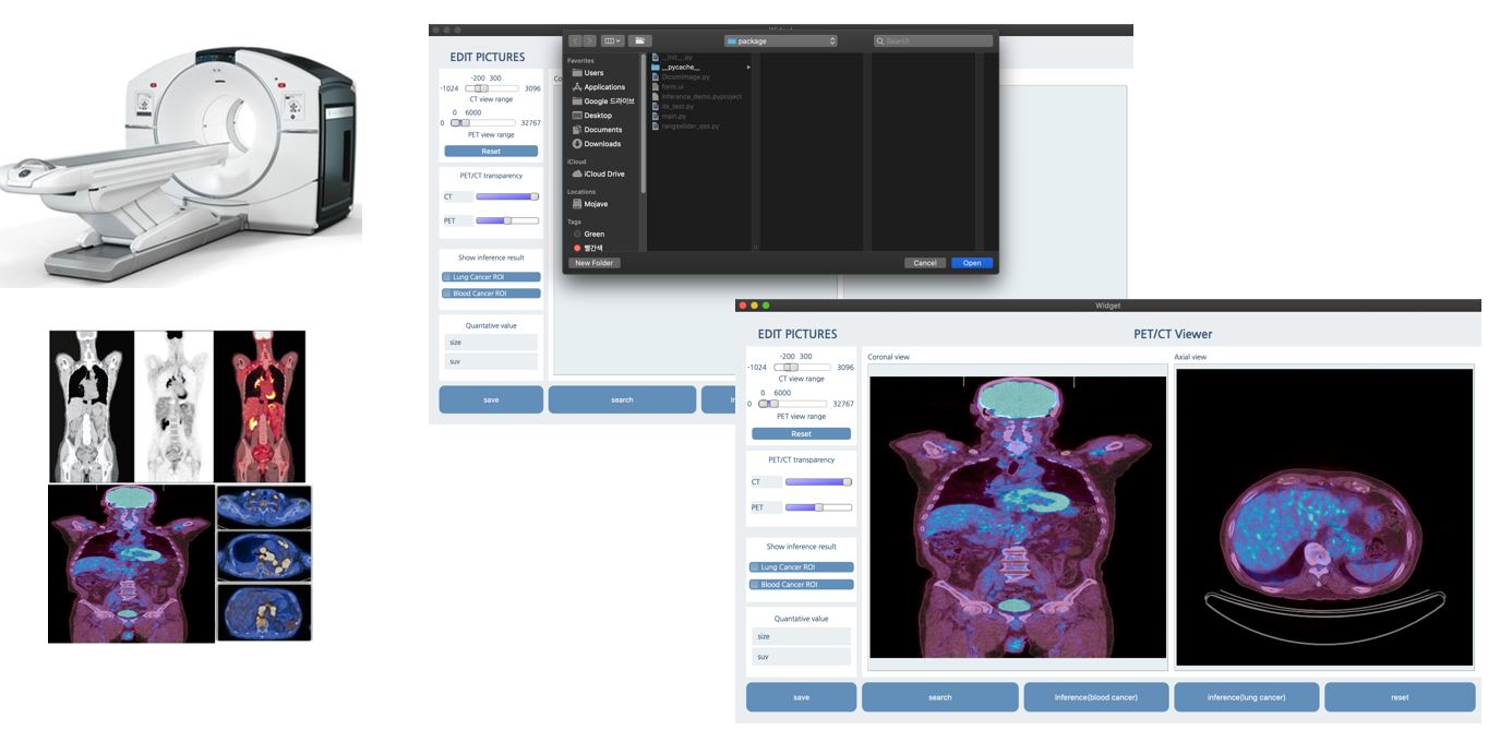 핵의학영상(PET) 이미지-서비스 활용 시나리오_1