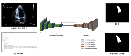 심장질환 진단을 위한 심초음파-AI 모델 개요_1