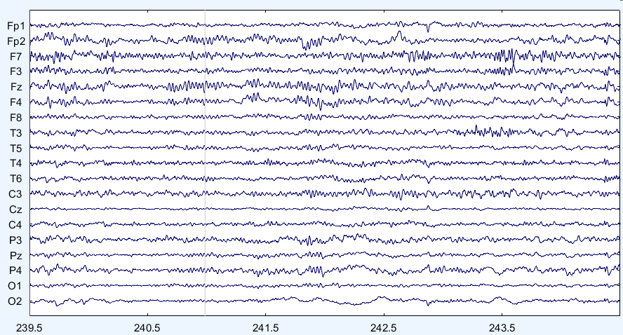 뇌파 데이터 시계열 데이터