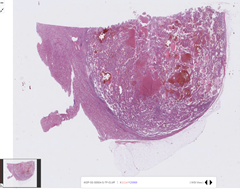 신장WSI_원천데이터 이미지
