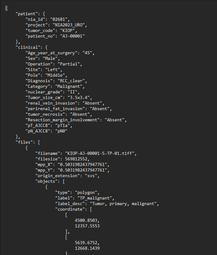 json 실제 예시 이미지