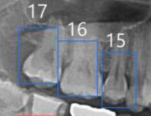 치과 진환 진단 의료 영상-어노테이션 포맷_1_라벨링 대상(치아 번호, Tooth Number)